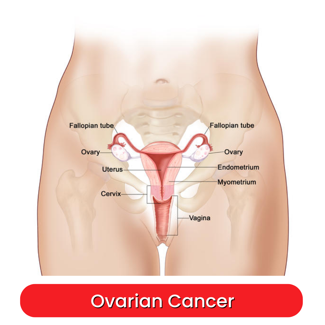 Cystoscopy Procedure In Denver, CO: A Comprehensive Guide